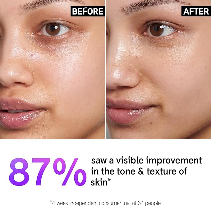 The INKEY List 15% Vitamin C and EGF Serum 1 Fl Oz, Reduces Hyperpigmentation, Rejuvenating Skin Care, Vegan Friendly, Suitable For All Skin Types