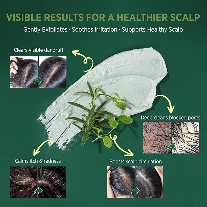 RoyceDerm Rosemary Mint Scalp Scrub – Exfoliating Scalp Treatment for Oily, Flaky & Itchy Scalp – Supports Hair Growth, Oil Control & Dandruff Relief with Rosemary & Peppermint Oils, Menthol & Silica