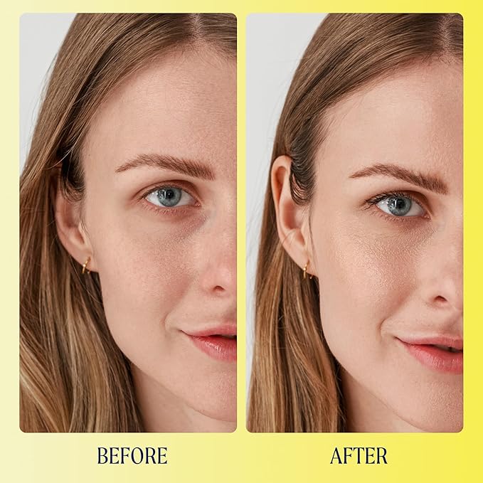 Kinship Brightwave Vitamin C Under Eye Brightener Cream for Sensitive Skin | Dark Circles Under Eye Treatment | Diminishes Fine Lines | Hydrating Eye Cream w/Antioxidants | Fragrance Free, (0.5 Oz)