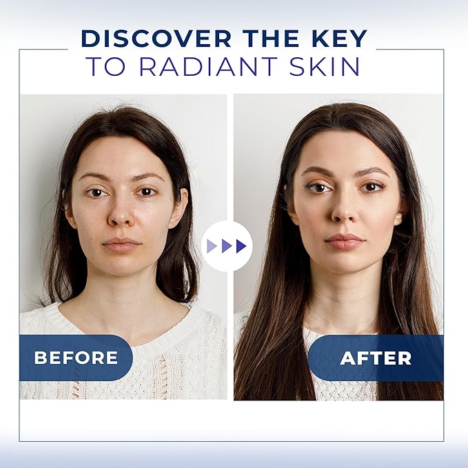 Hylunaric acid serum for Face - Acido Hialuronico B5 Serum for Women - Hydrating Serum for Fine Lines, Wrinkles & Anti Aging - 30ml