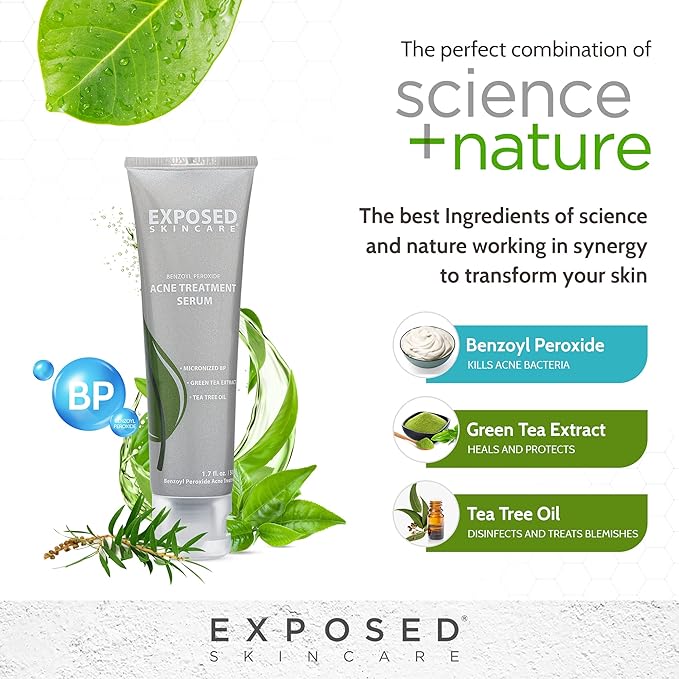 Exposed Skin Care, Acne Treatment Serum with 3.5% Benzoyl Peroxide – Lightweight Acne Spot Treatment – Quickly Clear Teen, Adult, Hormonal and Cystic Acne – Natural, Non-toxic and Cruelty Free