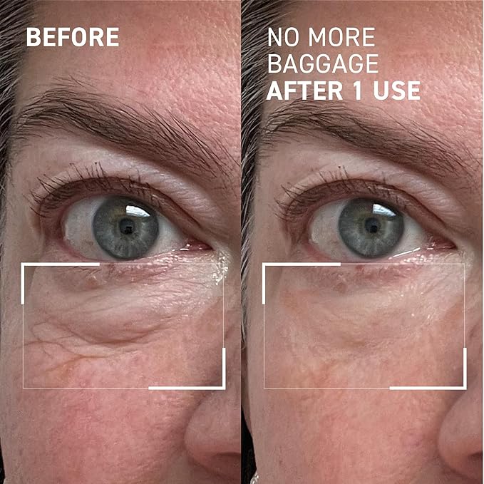 Dr. Brandt Needles No More, No More Baggage - 0.25 oz, Pack of 2 - Minimizes Under-Eye Bags, Puffiness & Dark Circles