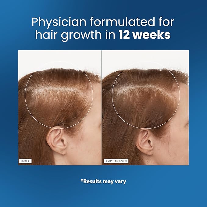 Be Bodywise Rosemary Hair Growth Serum Roll On 25 ml – 3% Rosemary, 3% Redensyl & 2% Anagain | DHT-Blocking Scalp Serum Boosts Oxygen Flow, Reduces Hair Fall | Paraben/Sulfate-Free | Women & Men