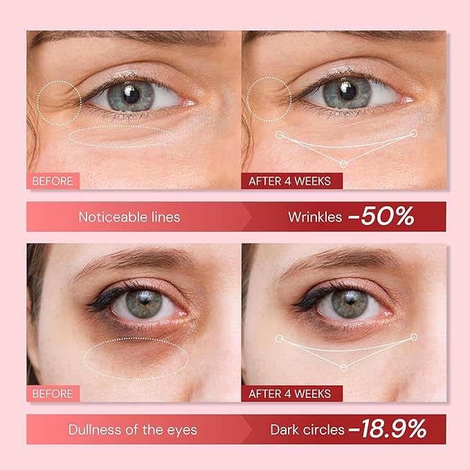 EnaSkin Retinol Anti-Aging Eye Cream: Instant Under Eye Bags Treatment & Rapid Wrinkle Repair - Tightening & Reduce Puffiness for Women, Day & Night, 0.85 fl.oz