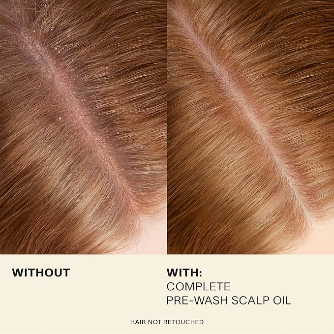 JVN Pre-Wash Scalp Oil & Hair Treatment Oil, Pre Shampoo Dry Scalp Treatment, Scalp Cleansing Oil for All Hair Types, Sulfate Free (1.7 Fl Oz)